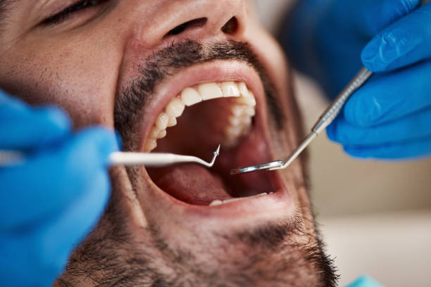 Best Broken or Chipped Tooth Repair in Minersville, PA
